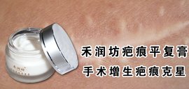 手术增生性疤痕