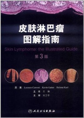 皮肤淋巴瘤图解指南