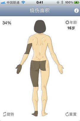 烧伤面积计算器