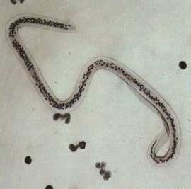 毛首鞭形线虫