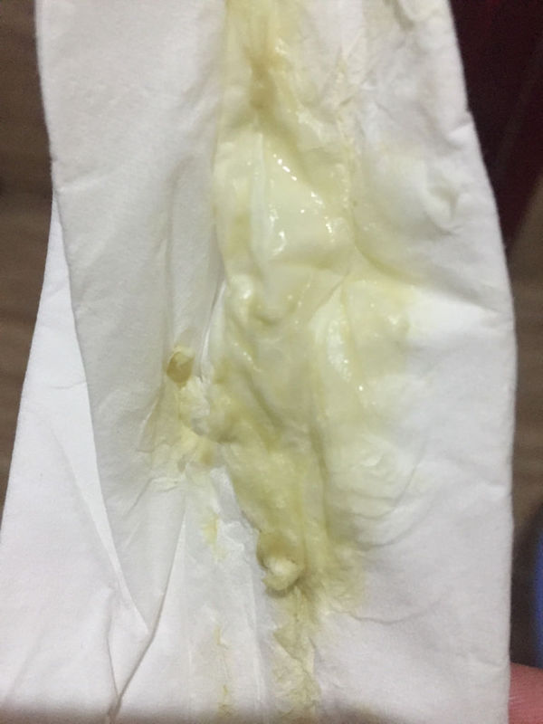 怀孕六个月!分泌物很多!有图!嫌弃勿进_360问