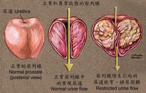 前列腺平滑肌图片图片